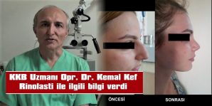 KKB UZMANI OPR. DR. KEMAL KEF, RİNOLASTİ İLE İLGİLİ BİLGİ VERDİ